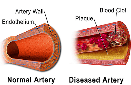Blood Clot Formation