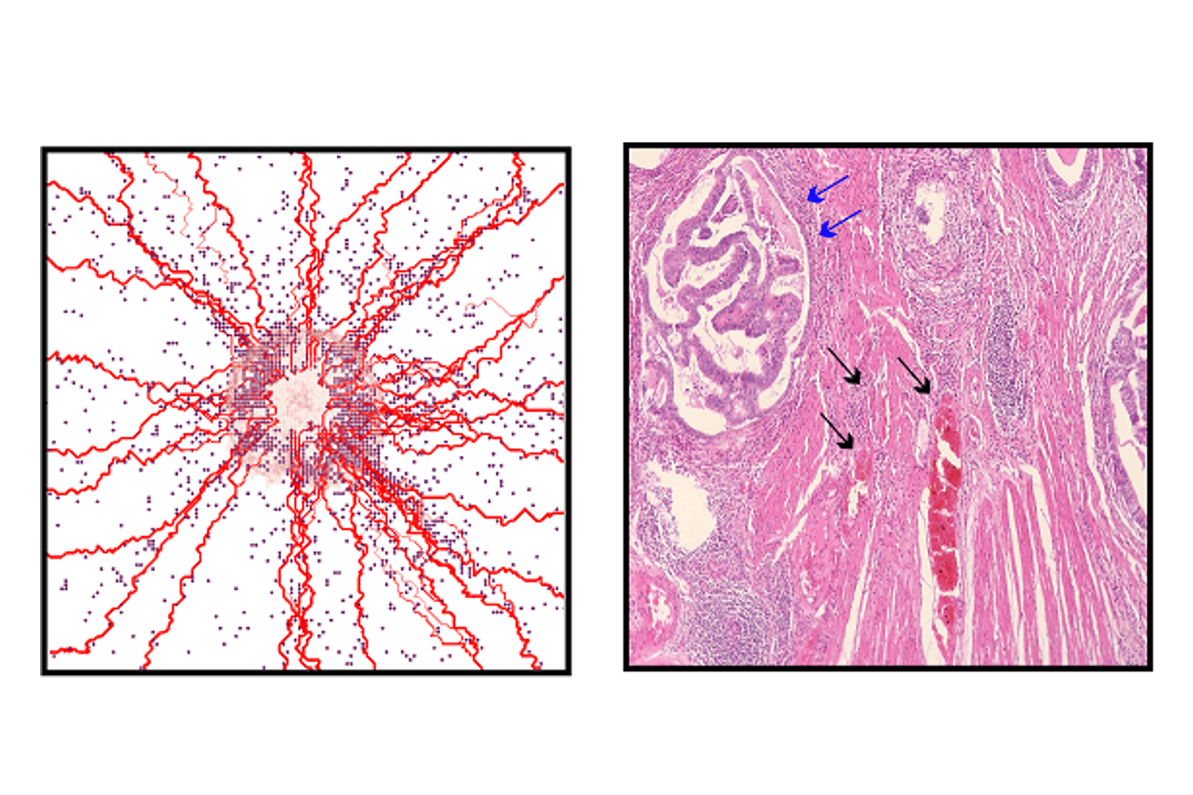 Tumor Growth and Immunotherapy